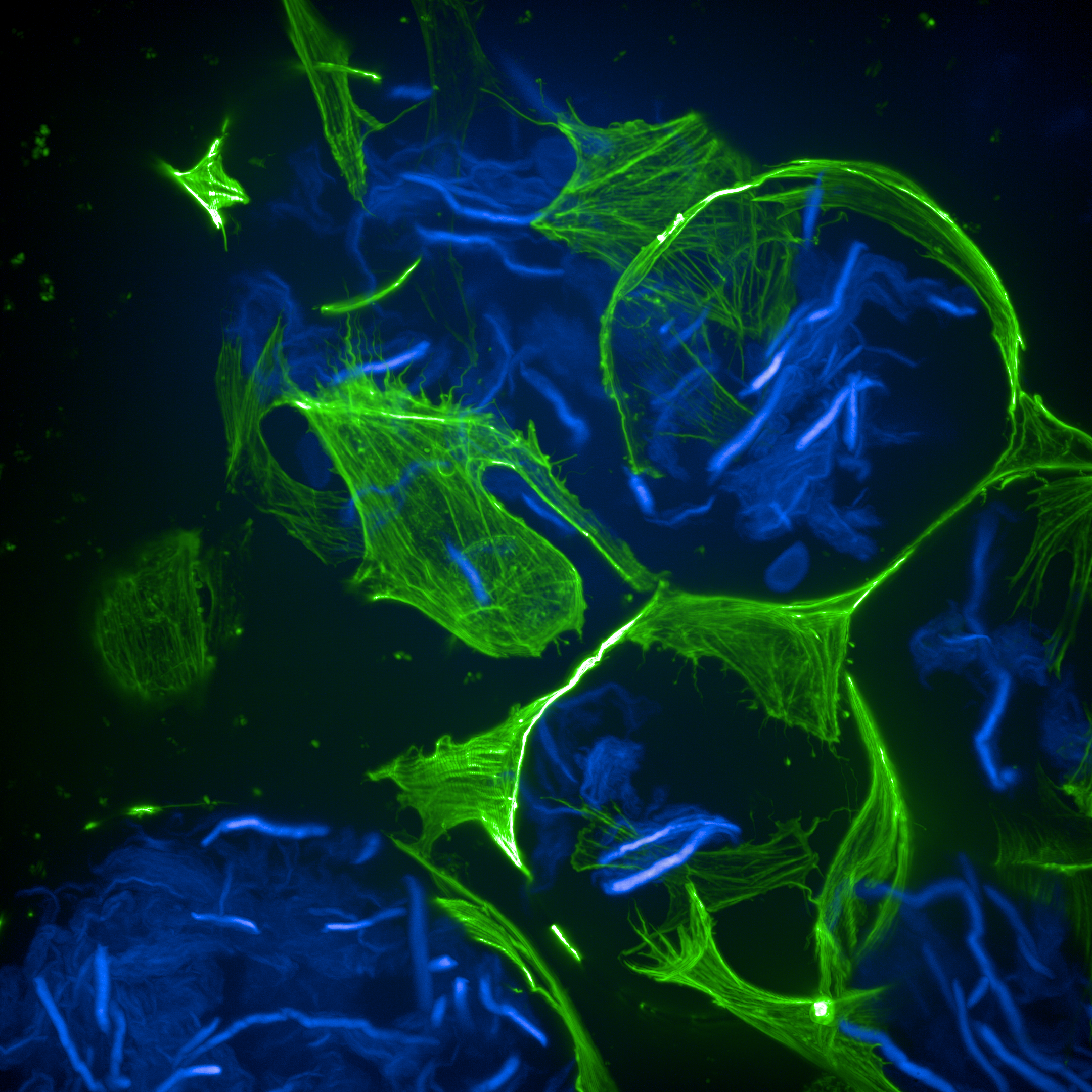 Image of fibroblasts on microgels at 63X magnification