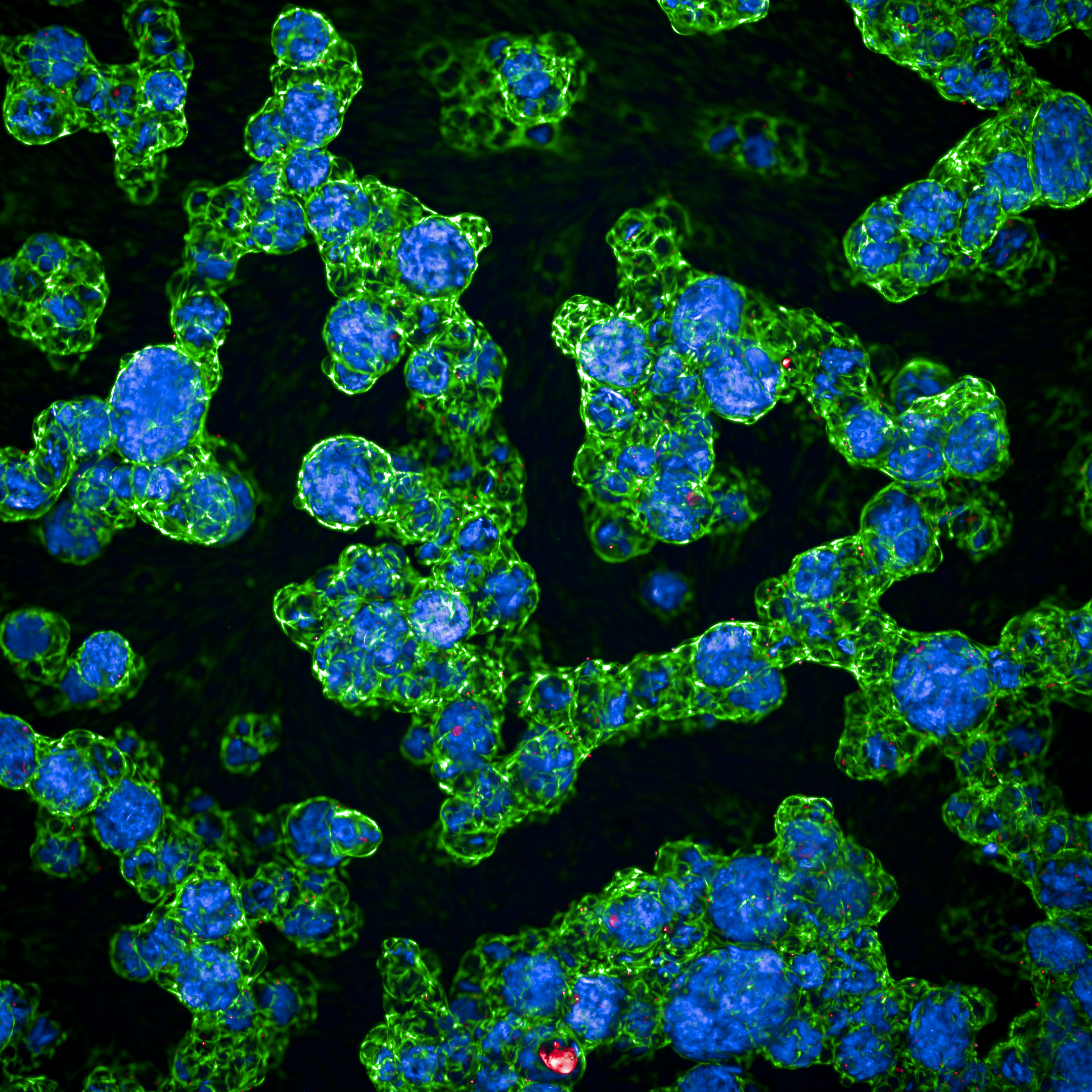 Image of fibroblasts on microgels at 5X magnification